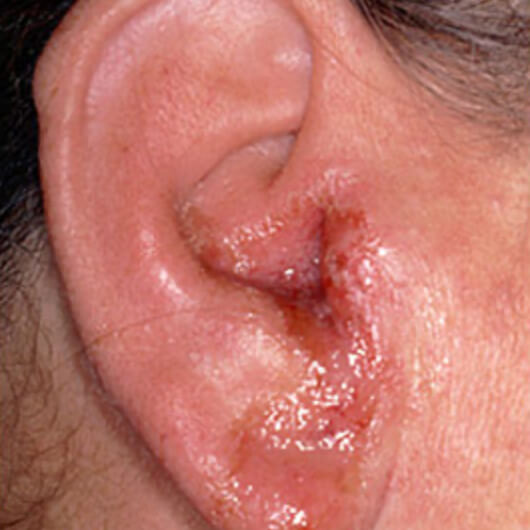 Чешется за ушами: возможные причины и заболевания